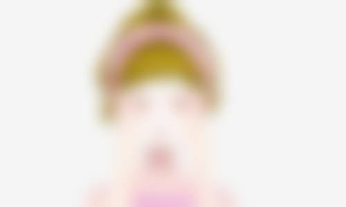 三、预防全割双眼皮消失的方法