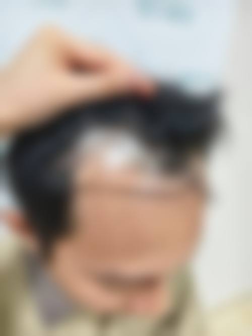 四、乌鲁木齐平修琳医疗美容诊所特色项目