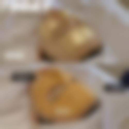 九、永州潇洒整形医疗美容门诊部真实的患者评价