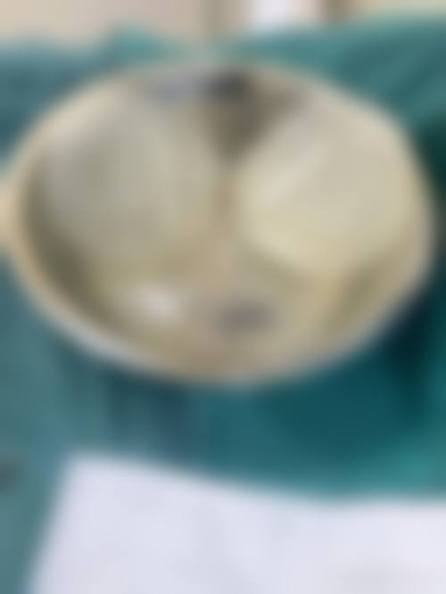 六、永州潇洒整形医疗美容门诊部价格表