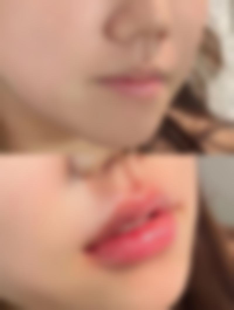 五、常熟卡莱丽整形医院价格表