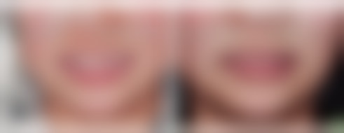 三、丁文蕴技术优势