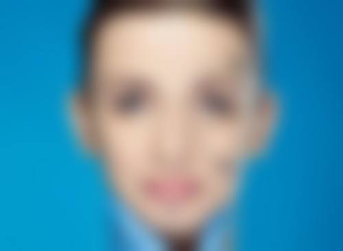 四、鼻唇沟疤痕修复之手术治疗