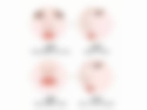 三、疤痕体质可以做去眼袋手术吗？手术对疤痕体质人群的风险