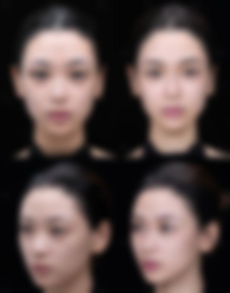 八、荆门东鑫美来整形医疗美容门诊部真实的患者评价