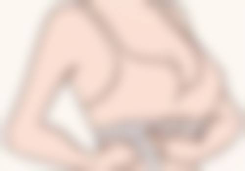 二、疤痕疙瘩的治疗方式