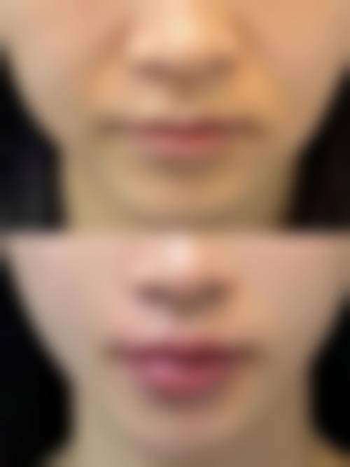 三、义乌美时美刻医疗美容门诊部诊疗项目有哪些？