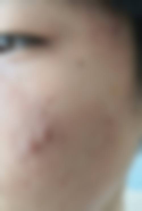 二、杨燕飞擅长项目