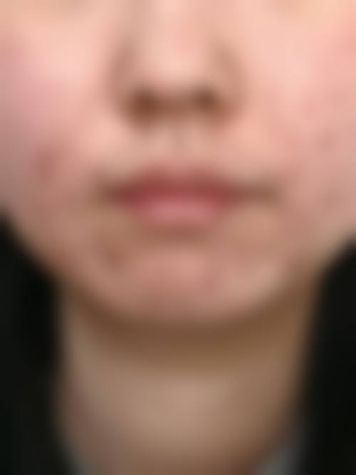 六、杨燕飞真实的患者评价