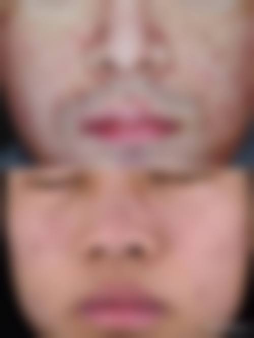 七、南充贞肤整形医院预约方式