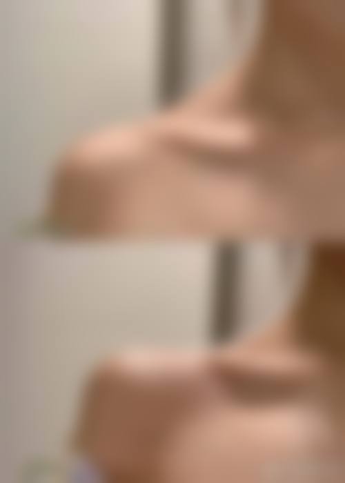 四、宁德韩美医疗美容医院特色项目