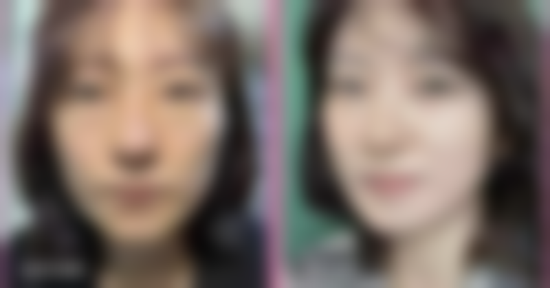 三、祛黑眼袋的日常护理