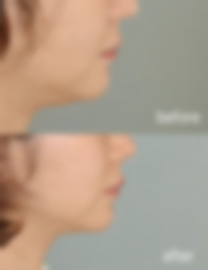 四、日常注意事项