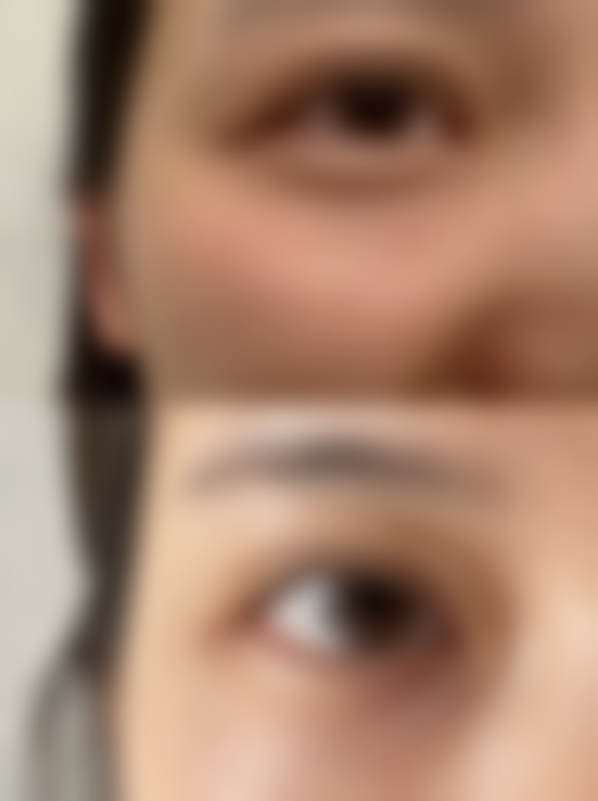 五、东莞伊嘉整形医院价格表