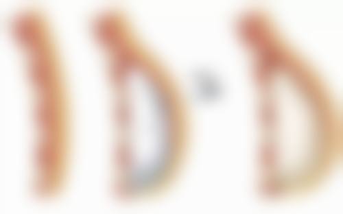 六、重度情况的应对方法