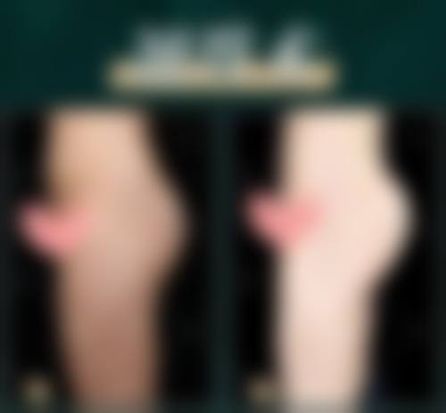 三、景丽峰医生的简介与擅长技术