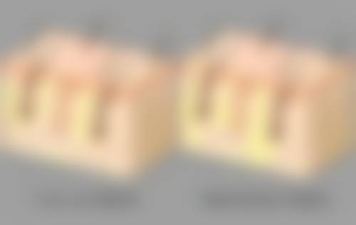 双眼皮拆线之后眼角有小疙瘩能修复好吗？