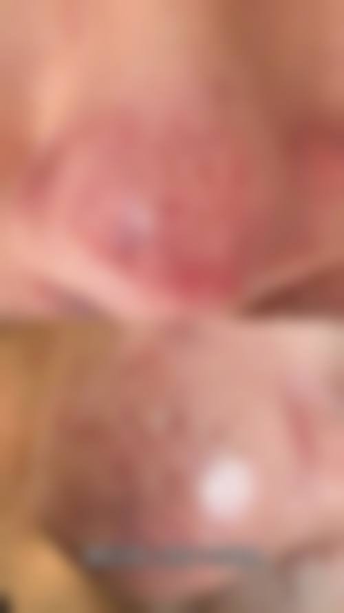 五、武汉润宜轩整形医院价格表