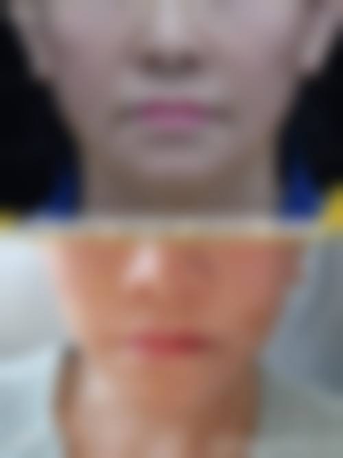 五、亚太医疗美容集团价格表