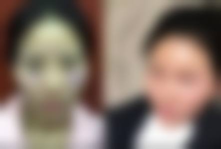 八、武汉润宜轩整形医院真实的患者评价