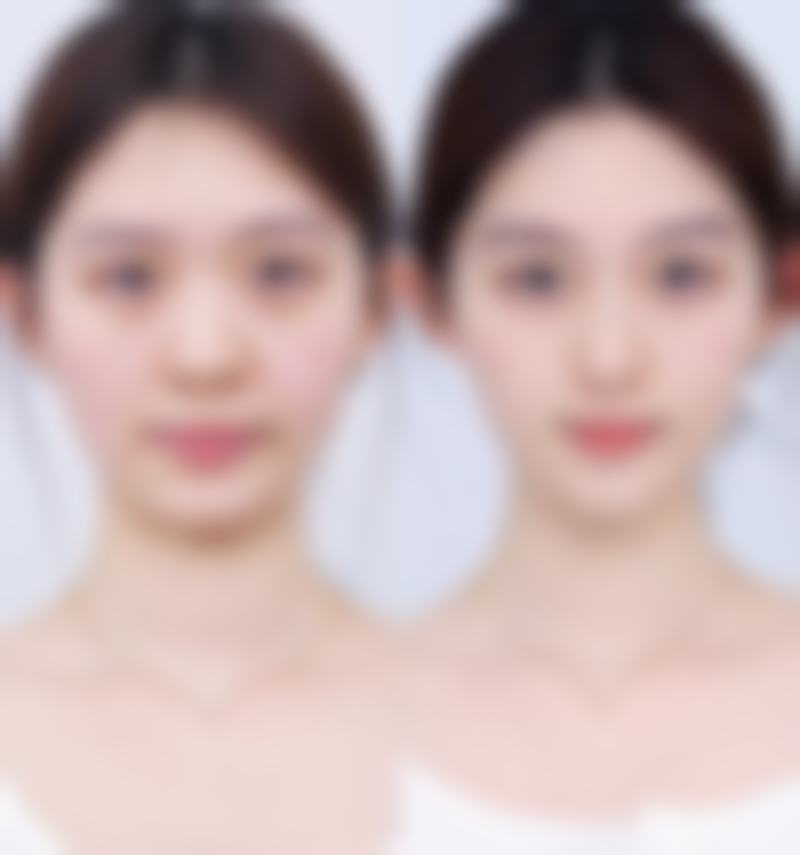 三、上饶平安医院整形美容研究所诊疗项目有哪些？