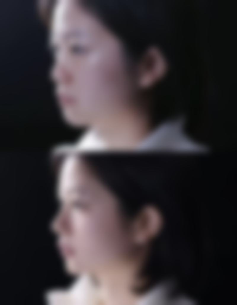 三、日常缓解老年人眼袋的方法