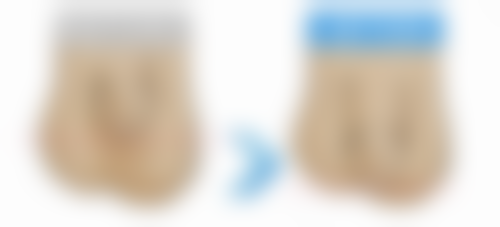 四、为什么做完双眼皮眼睛会模糊：结膜刺激因素