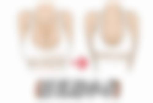 七、不同人群做全切双眼皮手术的情况