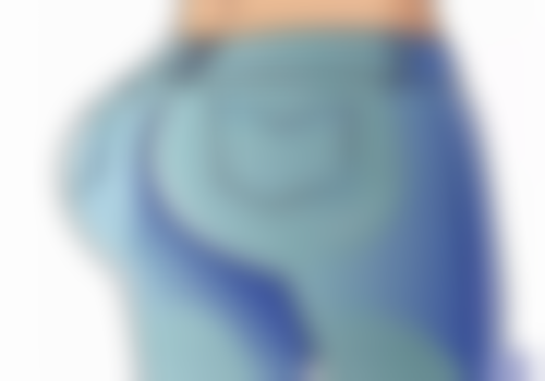 五、全切双眼皮手术的注意事项