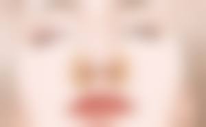 三、影响大腿抽脂后痒修复时间的其他因素