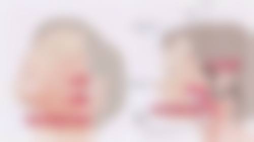 六、做完双眼皮眼睛模糊的修复时间及注意事项