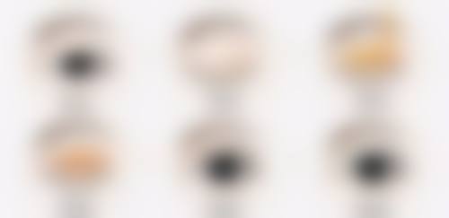 五、为什么做完双眼皮眼睛会模糊：感染因素