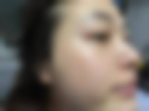 六、刘颖慧真实的患者评价