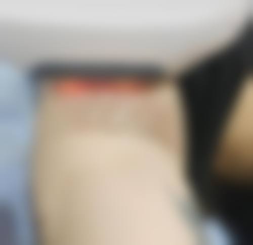 八、香港ProDerma医学美容及激光整形中 心真实的患者评价