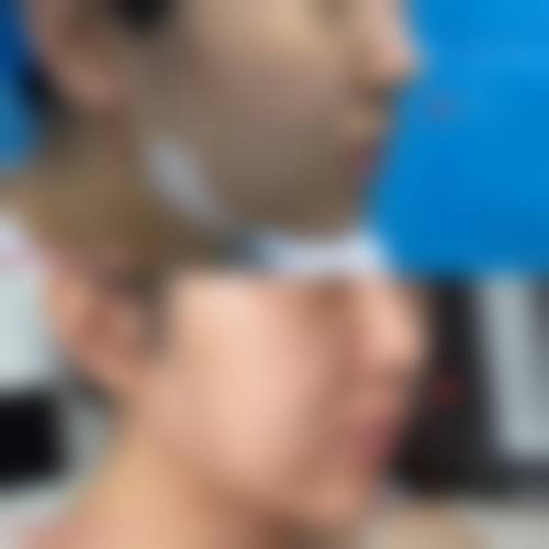 四、香港ProDerma医学美容及激光整形中 心特色项目