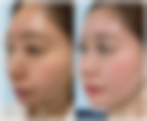 五、香港ProDerma医学美容及激光整形中 心价格表