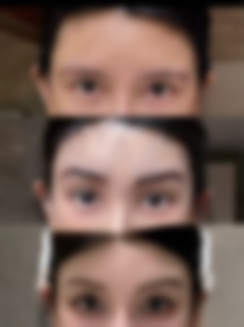 九、南宁碧莲盛医疗美容有限公司美容外科诊所真实的患者评价