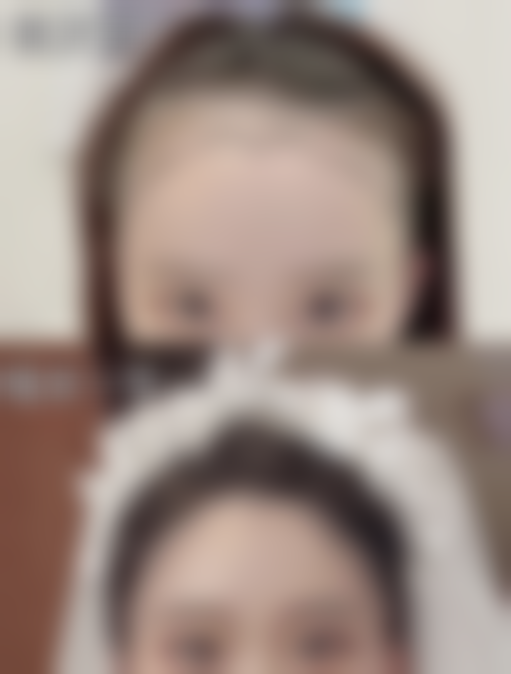 {瘦脸针100单位是一支吗？了解瘦脸针单位选择 50 单位还是 100 单位更适合你 