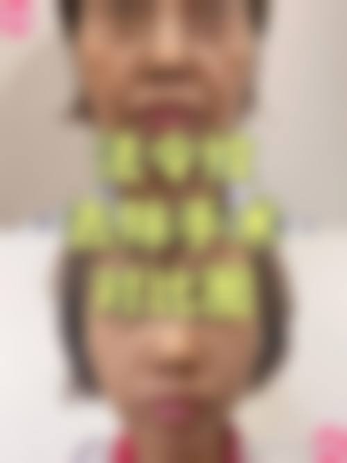 八、韩国李康元整形外科真实的患者评价