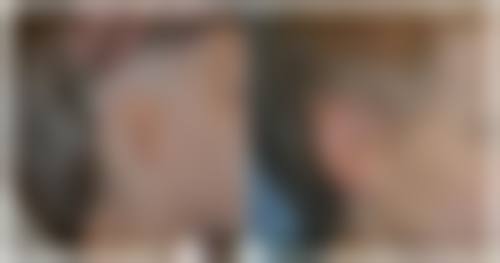 二、中山美熙整形医院怎么样？