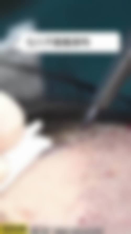 二、韩国李康元整形外科怎么样？