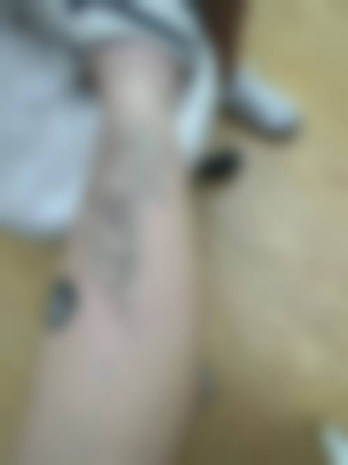 八、中山美熙整形医院真实的患者评价