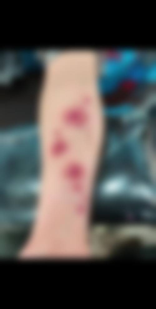 六、北京武警总医院医学美容整形中 心价格表