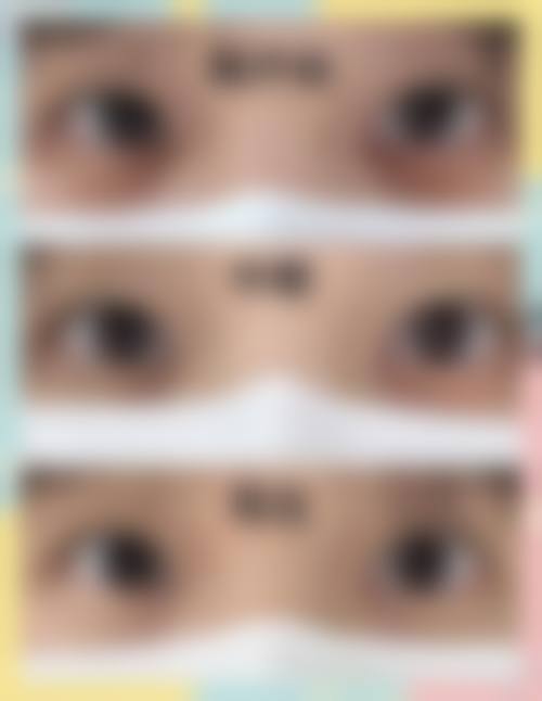 三、北京武警总医院医学美容整形中 心诊疗项目有哪些？