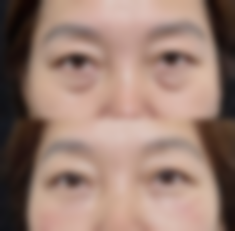 二、北京武警总医院医学美容整形中 心怎么样？