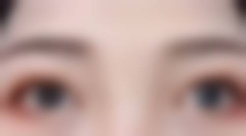 一、超脂塑吸脂的独特原理