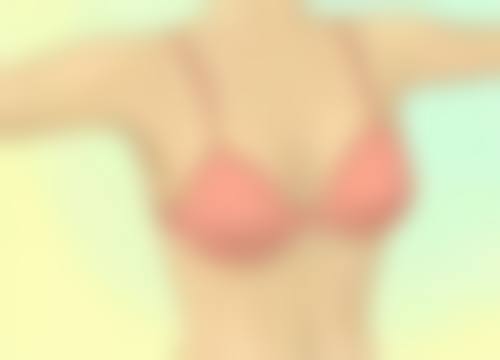 四、揭秘面部吸脂不反弹的秘密