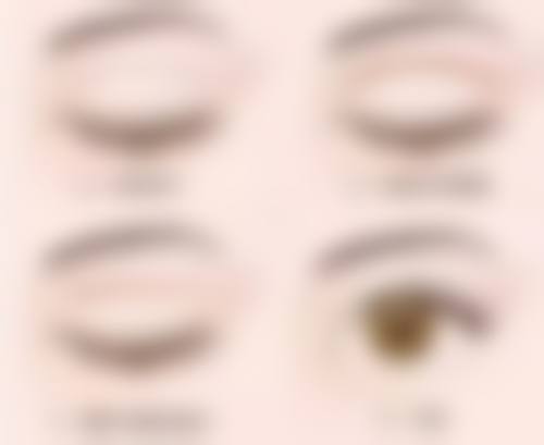 {凸性疤痕会自己消失吗？了解其自愈可能性及影响因素至关重要