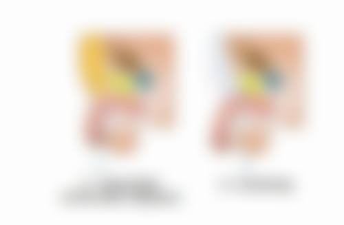 五、凸性疤痕的日常护理