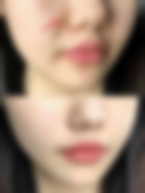 八、Ariel 大宫真实的患者评价